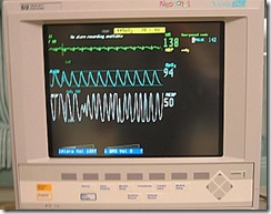 heart_respiration_o2_monitor